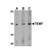 ProSci 4339 TEM7 Antibody