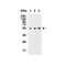ProSci 4349 MANF Antibody
