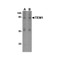ProSci 4359 TEM1 Antibody