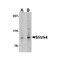 ProSci 4483 Slitrk4 Antibody