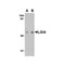 ProSci 4513 LGI4 Antibody