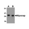 ProSci 4537 NIPSNAP Antibody