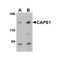 ProSci 4559 CAPS1 Antibody