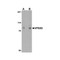 ProSci 4593 VPS53 Antibody