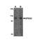 ProSci 4595 VPS53 Antibody