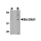 ProSci 4607 Slc35D1 Antibody