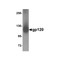 ProSci 4641 gp120 Antibody