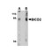 ProSci 4675 BICD2 Antibody