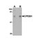 ProSci 4687 CPEB1 Antibody