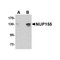ProSci 4703 NUP155 Antibody