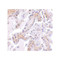 ProSci 4759 CAPN6 Antibody