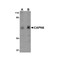 ProSci 4759 CAPN6 Antibody