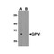 ProSci 4769 GPVI Antibody
