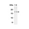 ProSci 4887 IL-17 Antibody