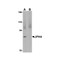 ProSci 4923 JPH4 Antibody