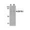 ProSci 4951 ZBTB1 Antibody