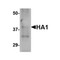 ProSci PM-4671 Hemagglutinin Antibody