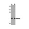 ProSci PM-5317 IRAK Antibody