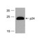 ProSci PM-6585-HRP HIV-1 p24 Antibody