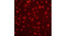 title: Delivery of Pep-A (Streptococcus TPE B epitope, 16 aa), into HeLa cells.; description: Complexes are formed with Pep-A (1 µg, lissamine-rhodamine derivative, Sigma) and PULSin® (4 µl). Observation is carried out 16 h post-delivery.