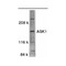 ProSci 1151 ASK1 Antibody