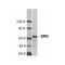 ProSci 1166 DR3 Antibody