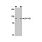 ProSci 5067 LRFN2 Antibody