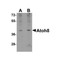 ProSci 5109 ATOH8 Antibody