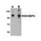 ProSci 5167 SH3BP4 Antibody