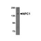 ProSci 5185 NPC1 Antibody