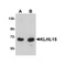ProSci 5223 KLHL15 Antibody