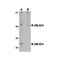 ProSci 5379 JMJD4 Antibody