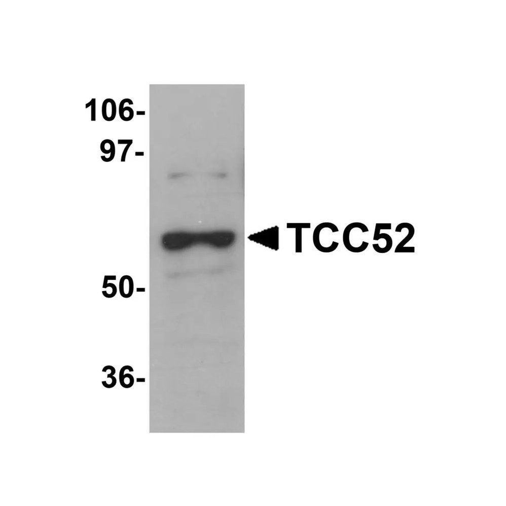 ProSci 5703 TCC52 Antibody