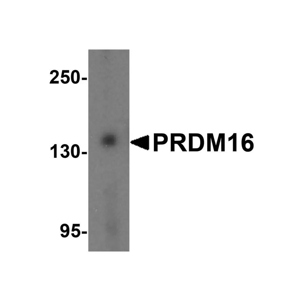 ProSci 5555 PRDM16 Antibody