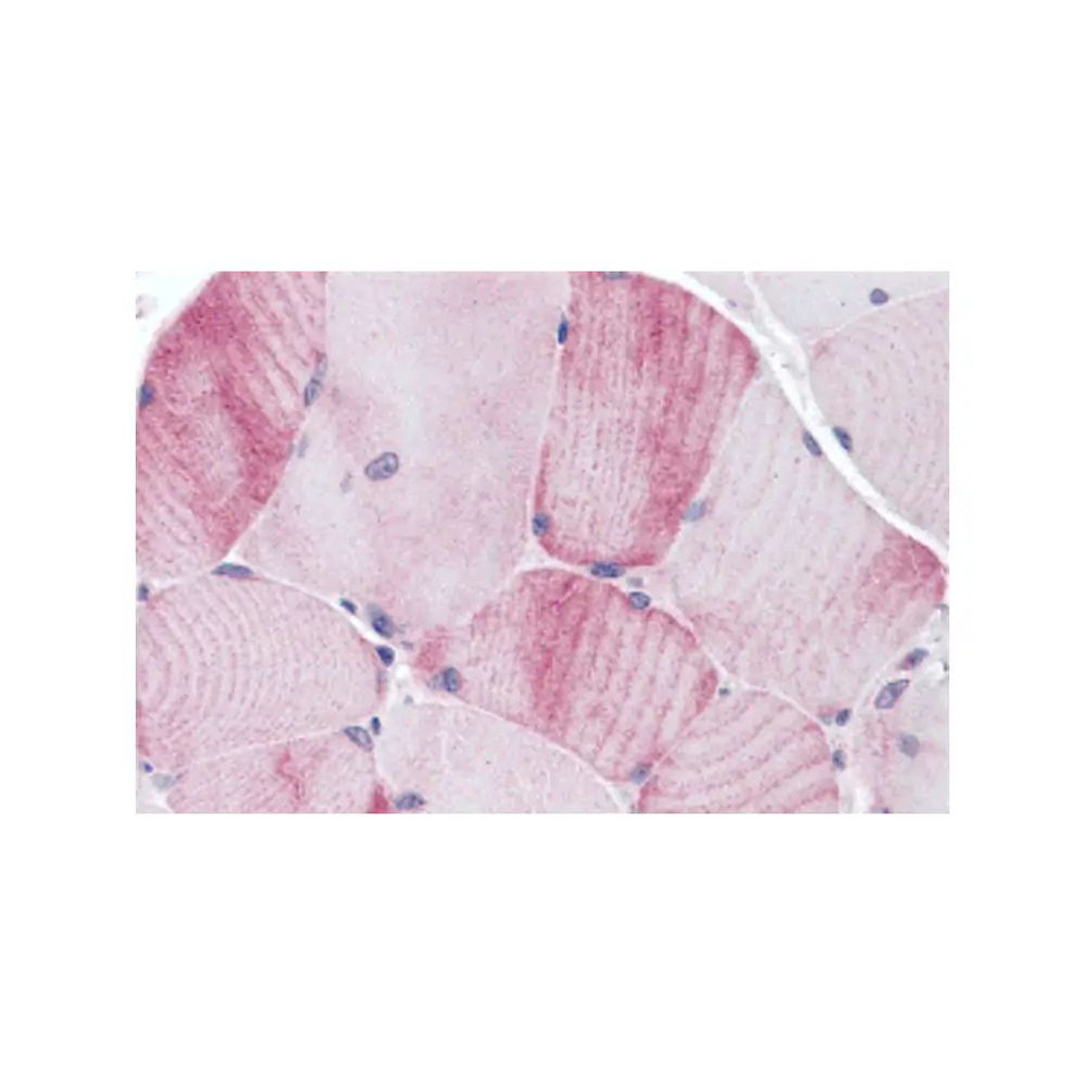 ProSci 5649 MYBPC1 Antibody