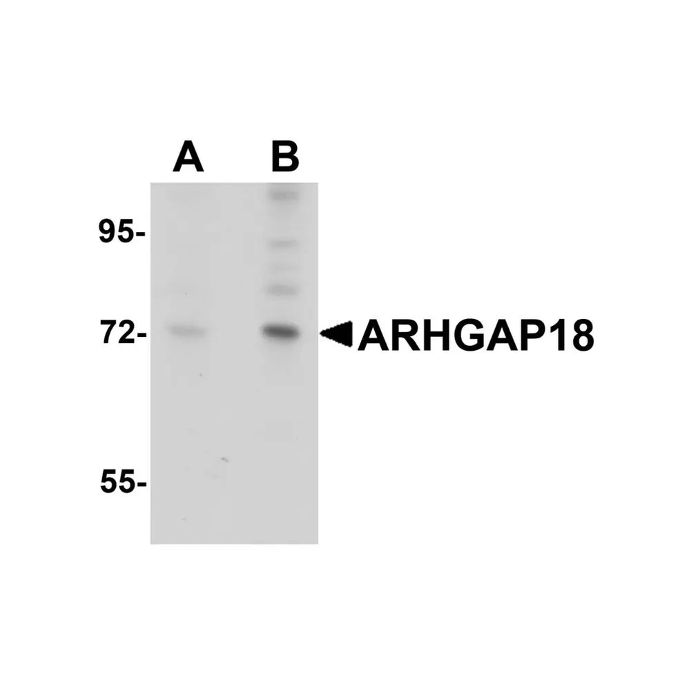 ProSci 5589 ARHGAP18 Antibody