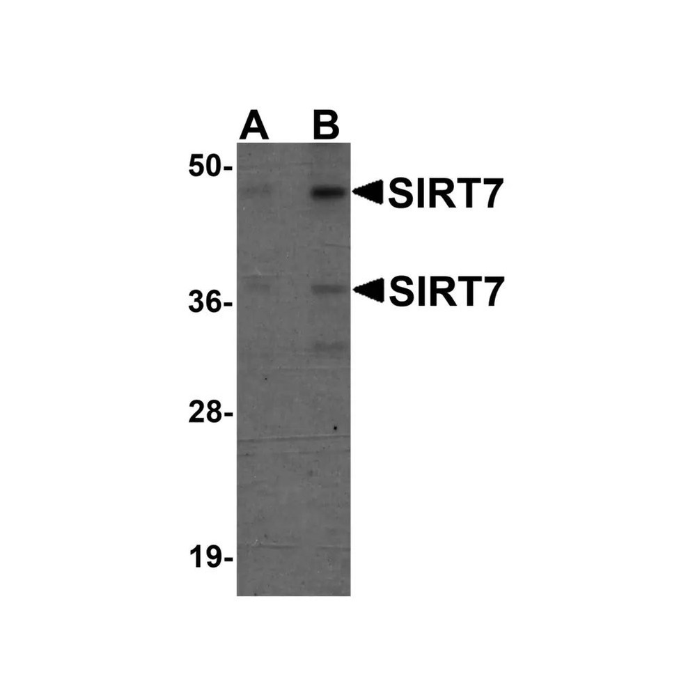 ProSci 5775 SIRT7 Antibody