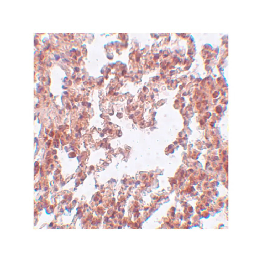 ProSci 5475 SRPX2 Antibody