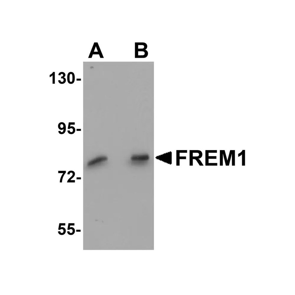 ProSci 5829 FREM1 Antibody