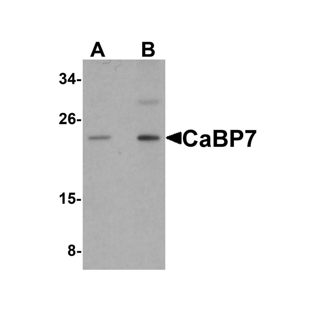 ProSci 5859 CaBP7 Antibody