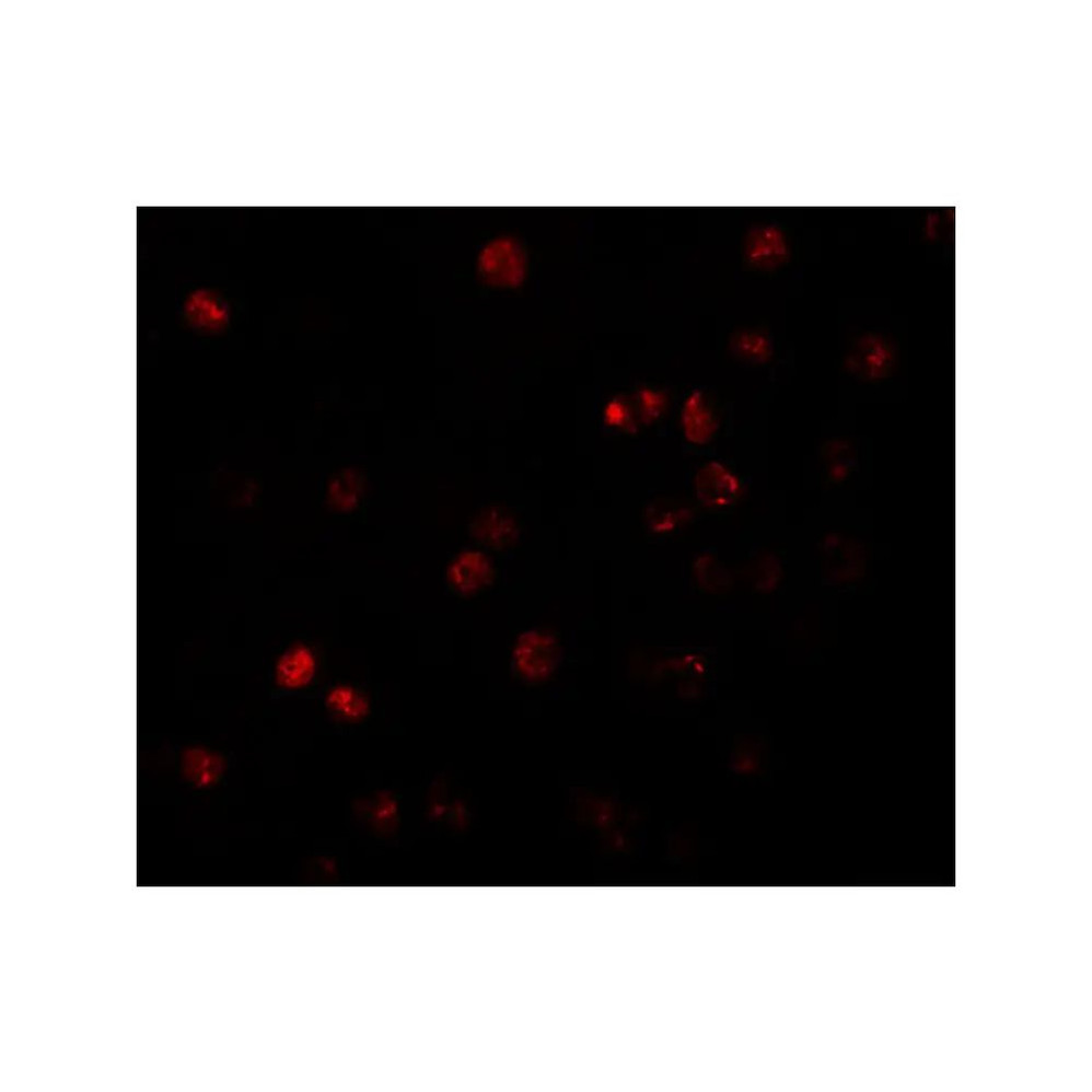 ProSci 5857 ATP11B Antibody