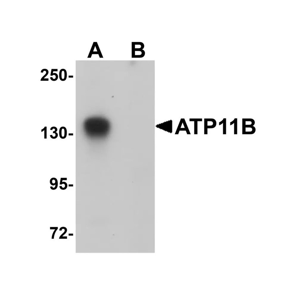 ProSci 5857 ATP11B Antibody