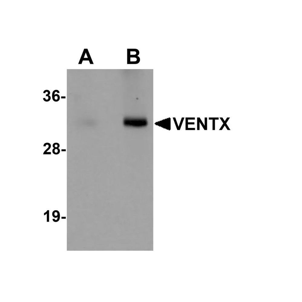 ProSci 5863 VENTX Antibody