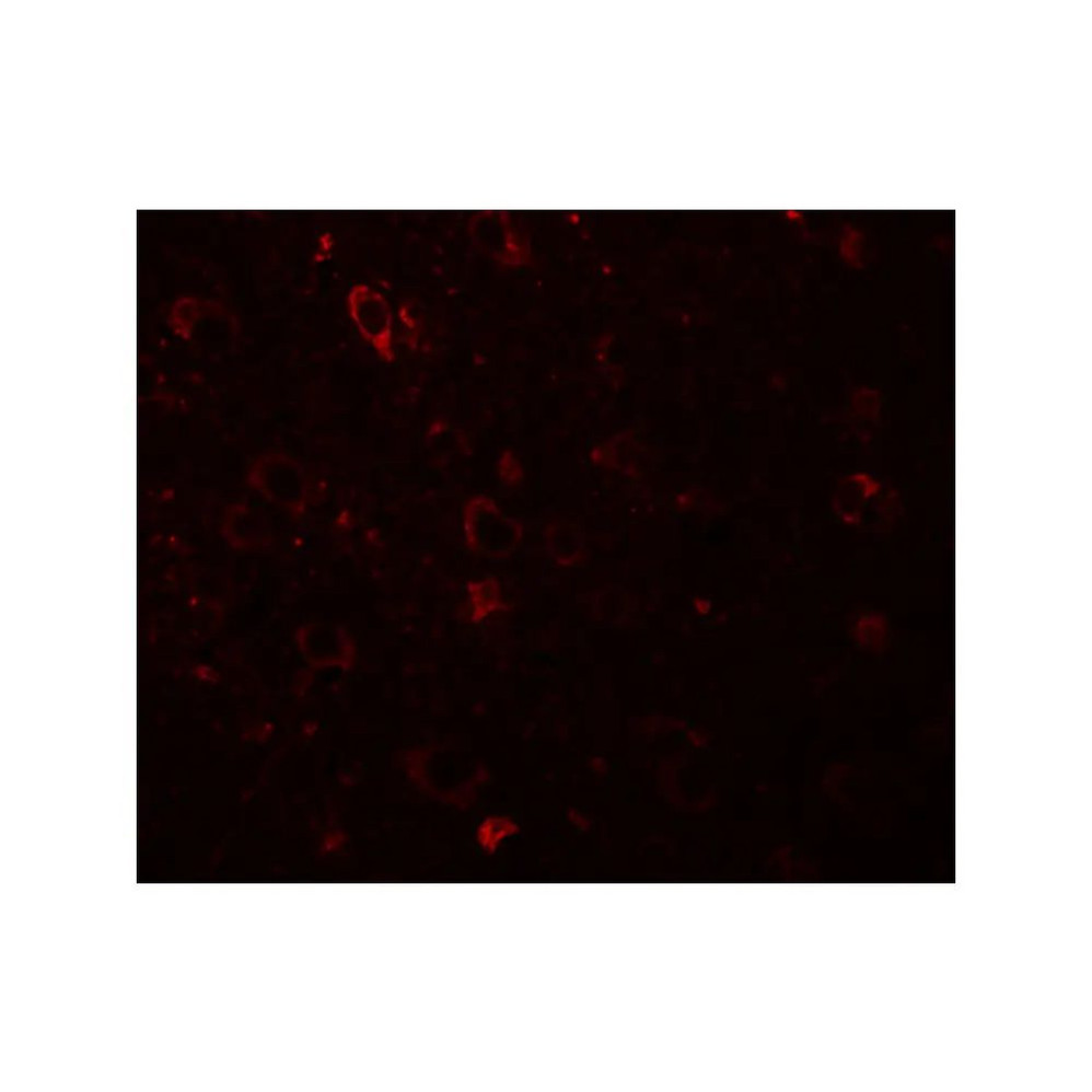 ProSci 5877 SESTD1 Antibody