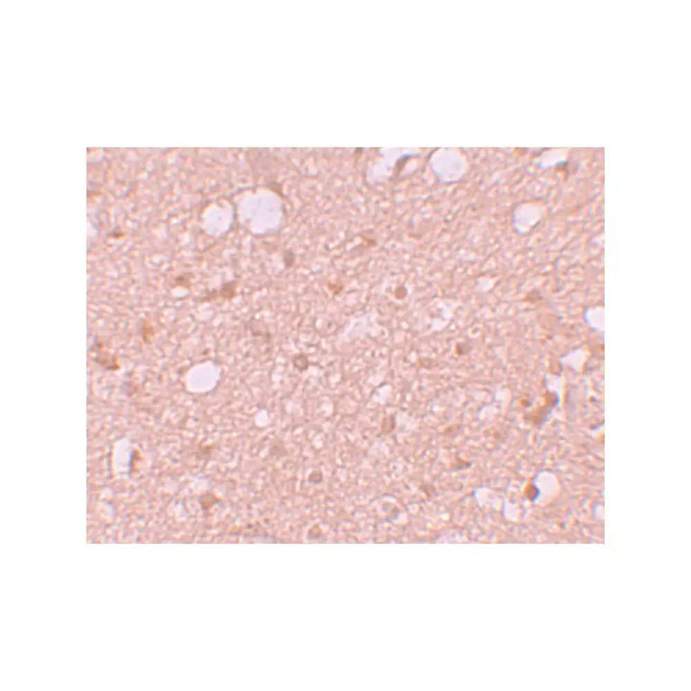 ProSci 5877 SESTD1 Antibody