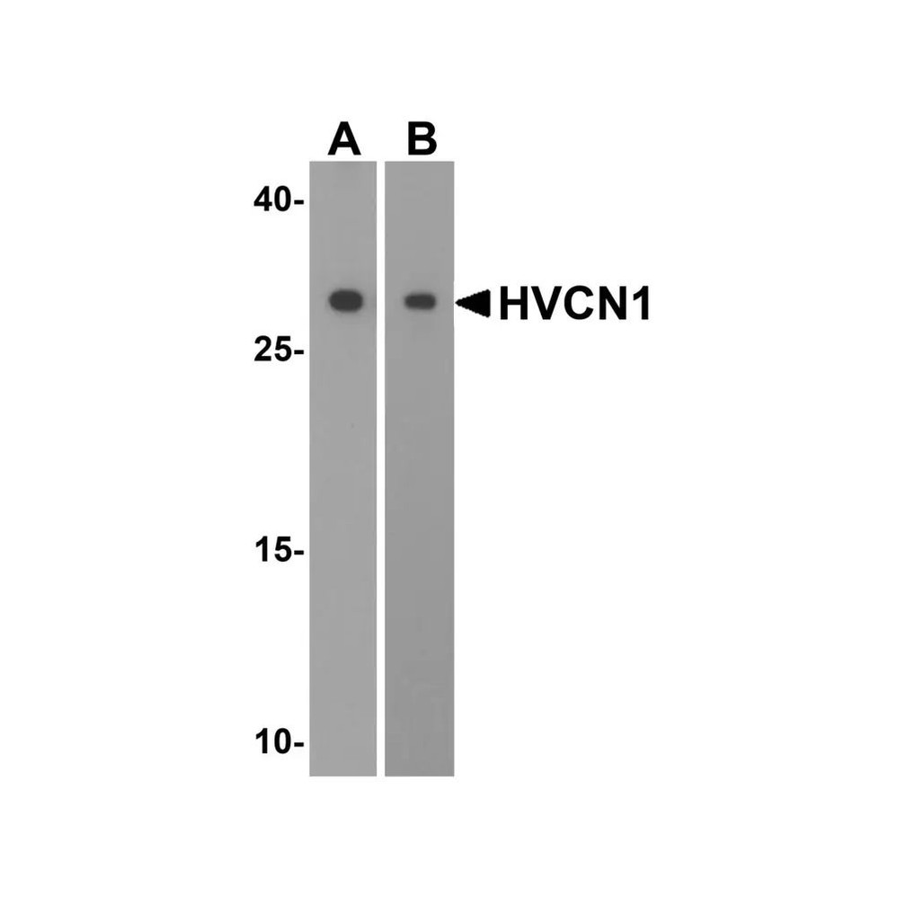 ProSci 5875 HVCN1 Antibody