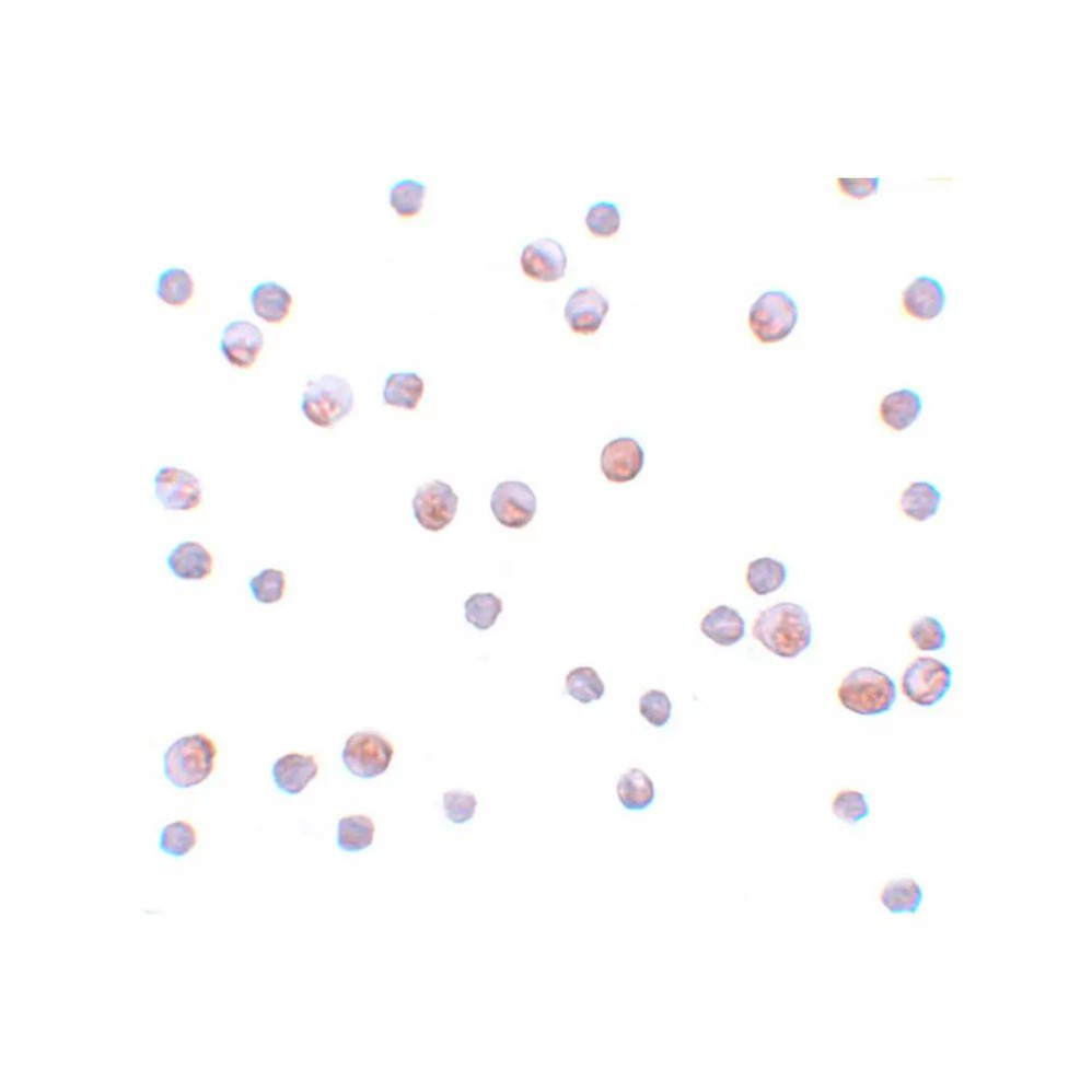 ProSci 5823 SIP1 Antibody