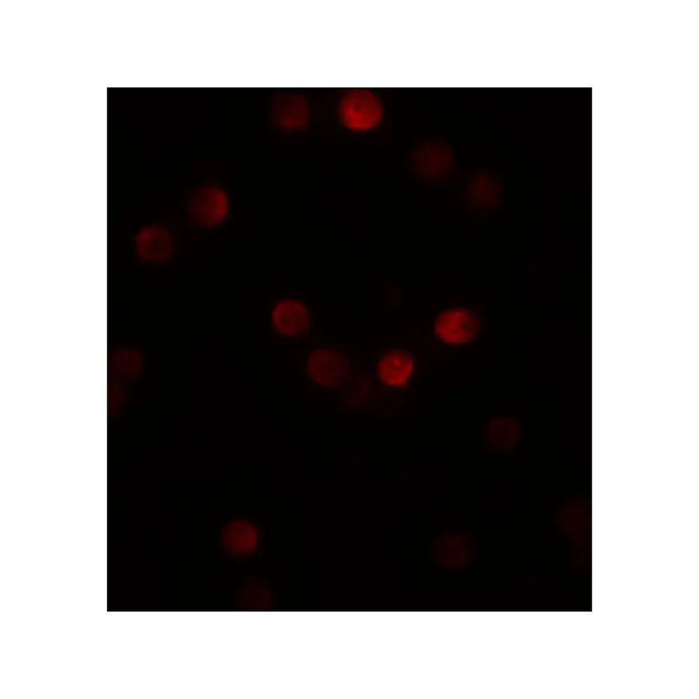 ProSci 5823 SIP1 Antibody