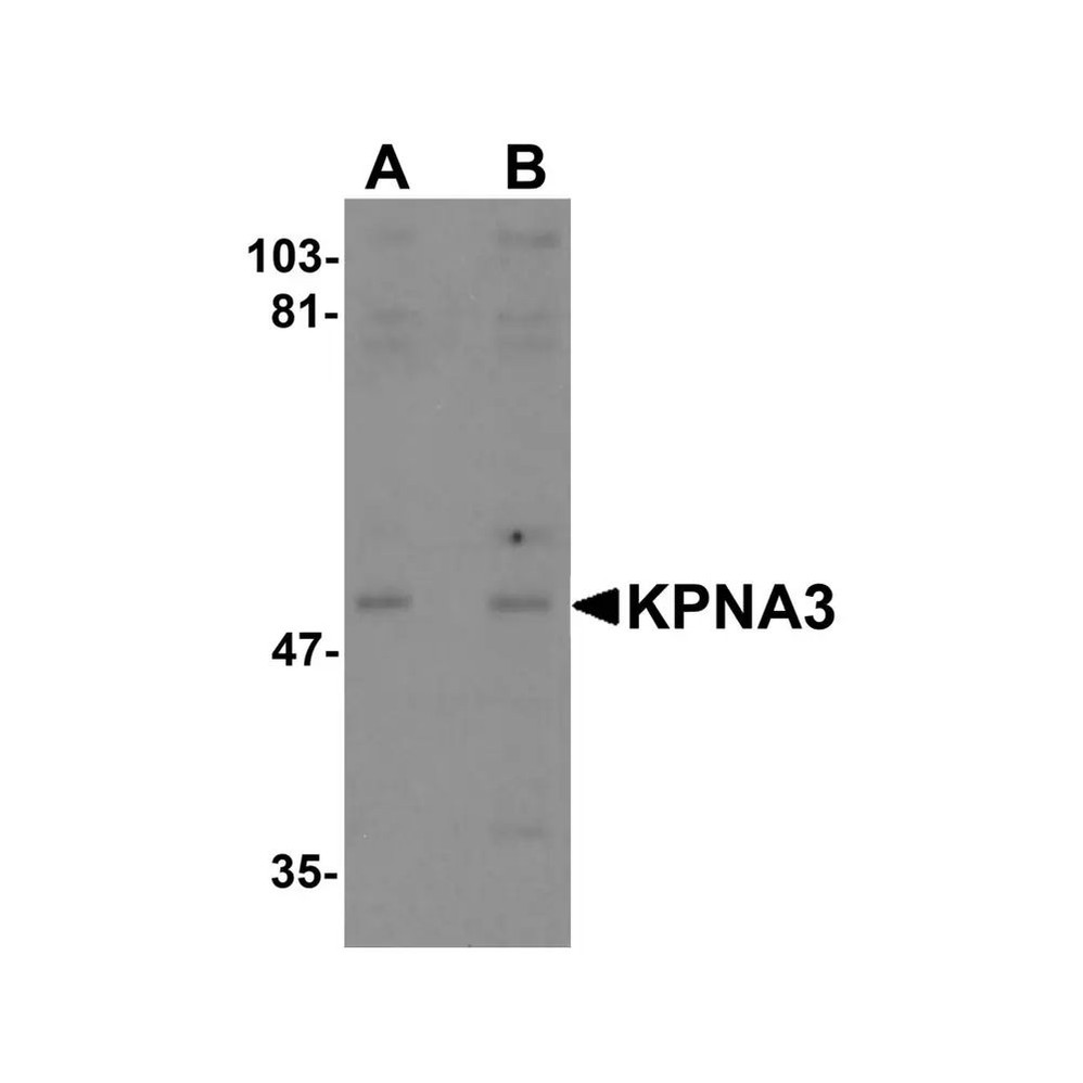 ProSci 5985 KPNA3 Antibody