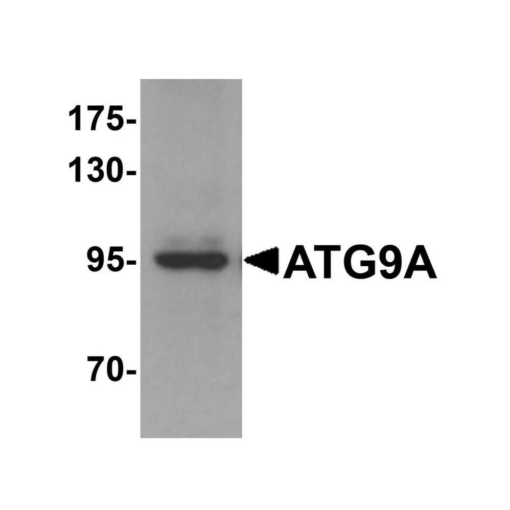 ProSci 6013 ATG9A Antibody